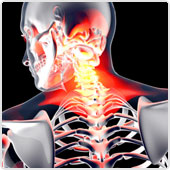 neck injury