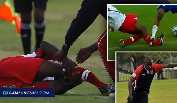 Oupa Ngulube leg injury