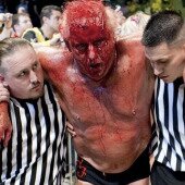 Ric Flair bleeding